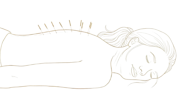 relaxed woman during acupuncture treatment - Camino Wellness Center
