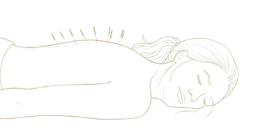relaxed woman during acupuncture treatment - Camino Wellness Center